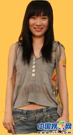 霍思燕从平胸到大胸对比图 胸部过大成畸形(组图)